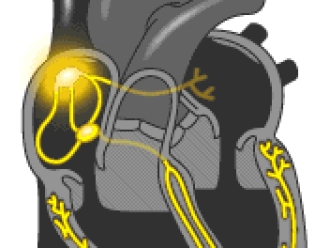 常见问题“解剖”冷冻式除湿机的心脏——压缩机