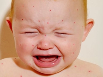 行业新闻湿疹频发？你需要除湿